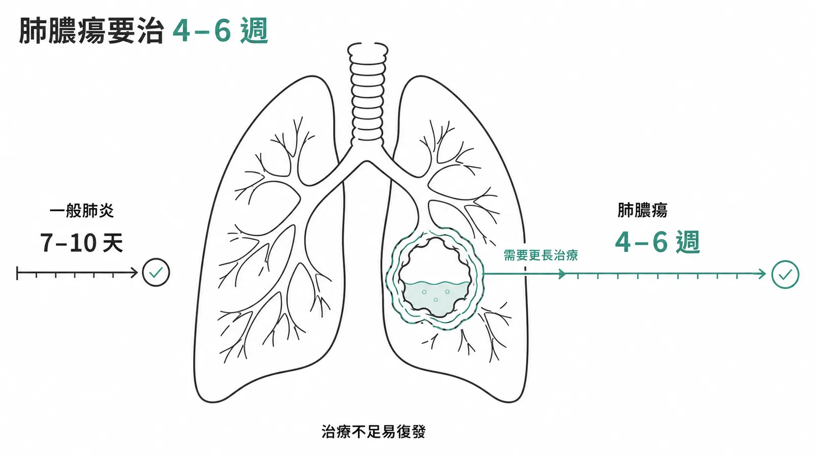 肺膿瘍需治療4-6週而非一般肺炎的7-10天