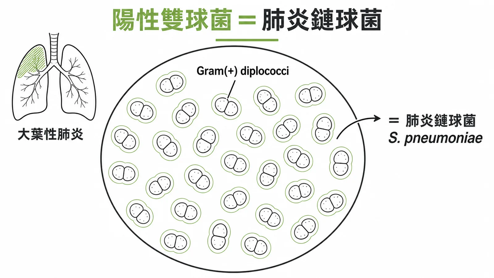 革蘭氏陽性雙球菌等於肺炎鏈球菌的顯微鏡辨識