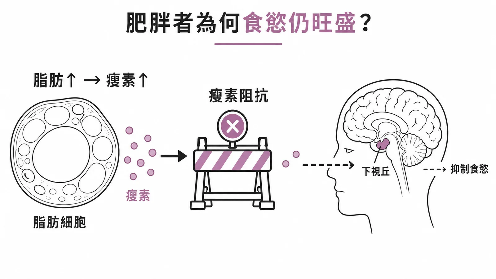 脂肪細胞分泌瘦素但因瘦素阻抗無法抑制下視丘食慾的信號路徑圖