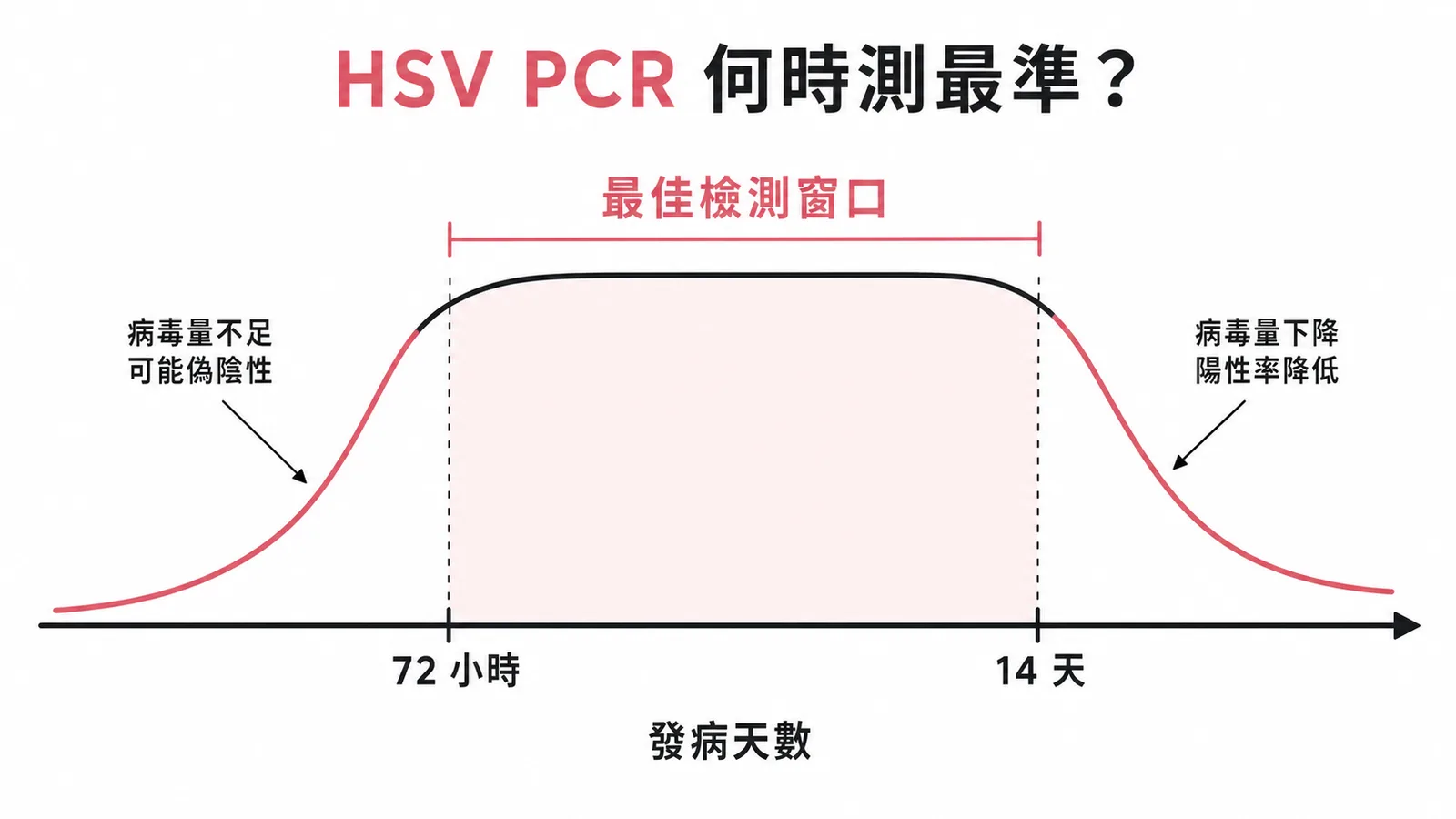 HSV 腦炎 CSF PCR 最佳檢測窗口在發病 72 小時至 14 天之間的曲線圖