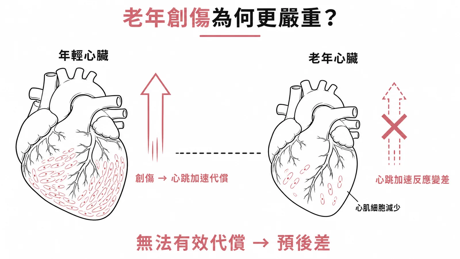老年創傷心率代償受限:年輕心臟可加速代償,老年心臟因心肌細胞減少無法有效代償