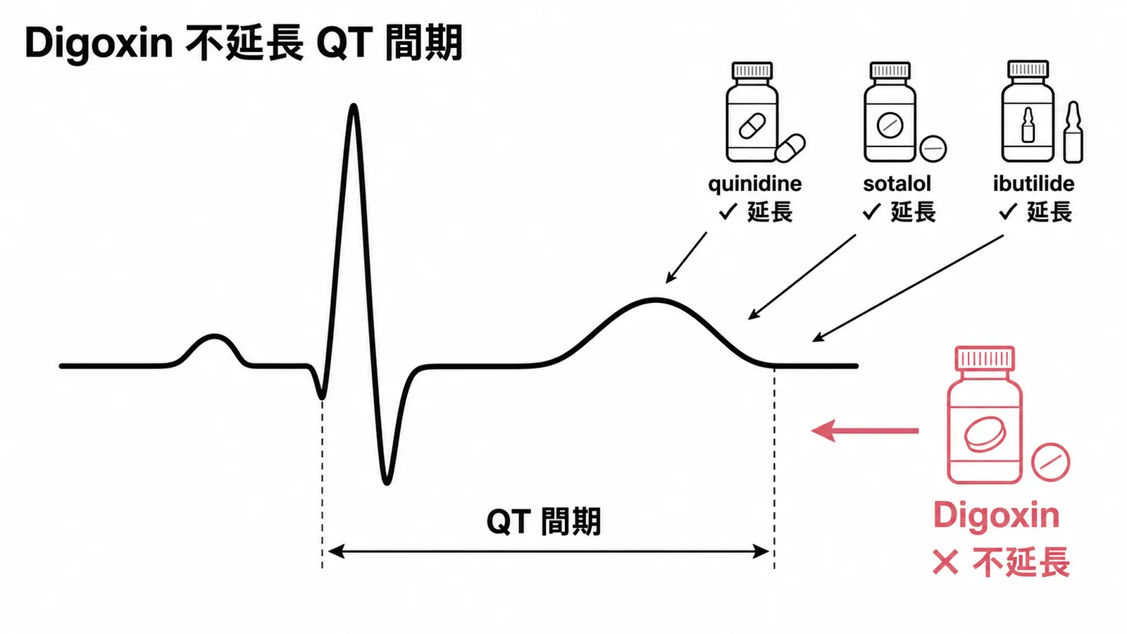 Digoxin 不延長 QT 間期,反而可能縮短