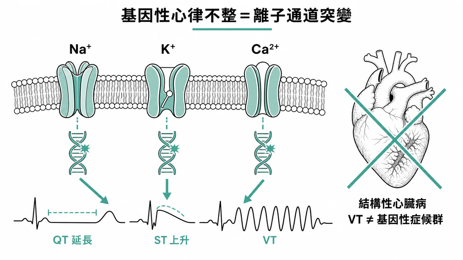 基因性心律不整症候群是離子通道突變導致的原發性電生理異常