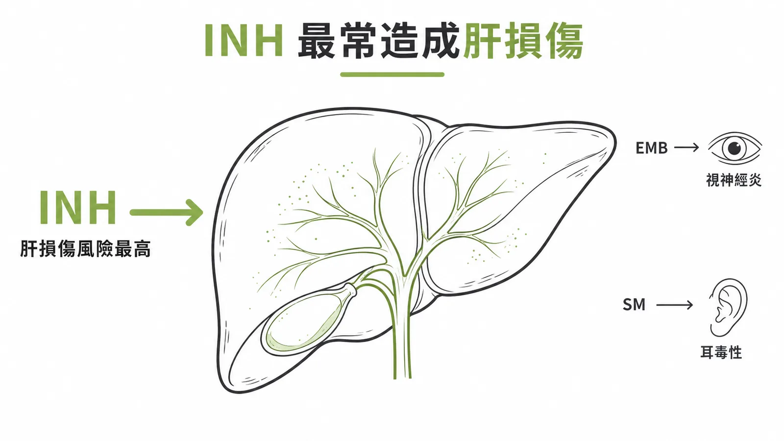 INH肝損傷風險最高,EMB致視神經炎,SM致耳毒性的器官對應示意圖