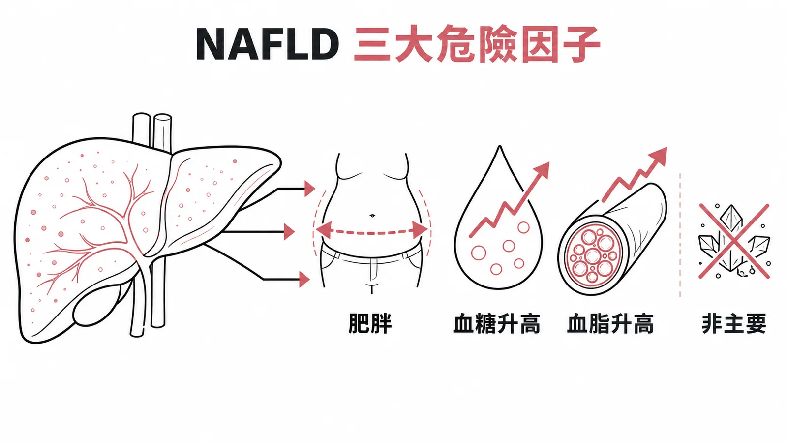 NAFLD 三大危險因子:肥胖、血糖升高、血脂升高,高尿酸血症為非主要因子