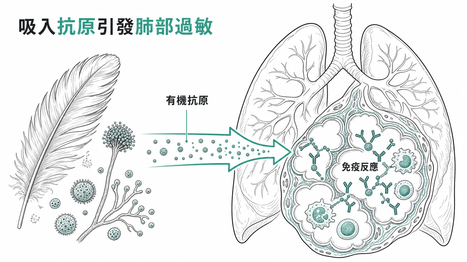 吸入有機抗原引發肺泡間質免疫反應的機轉