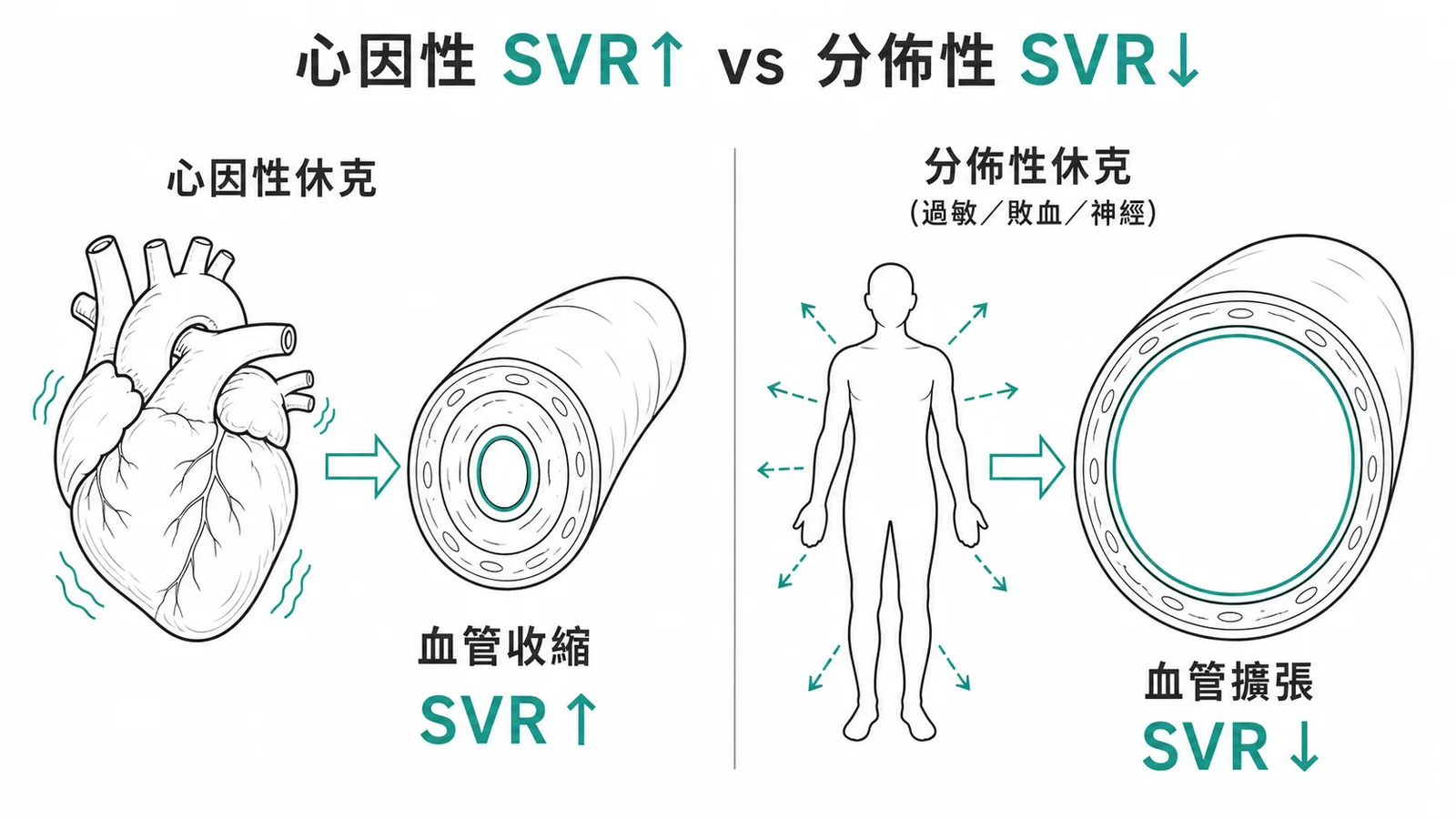心因性休克SVR升高與分佈性休克SVR降低對比