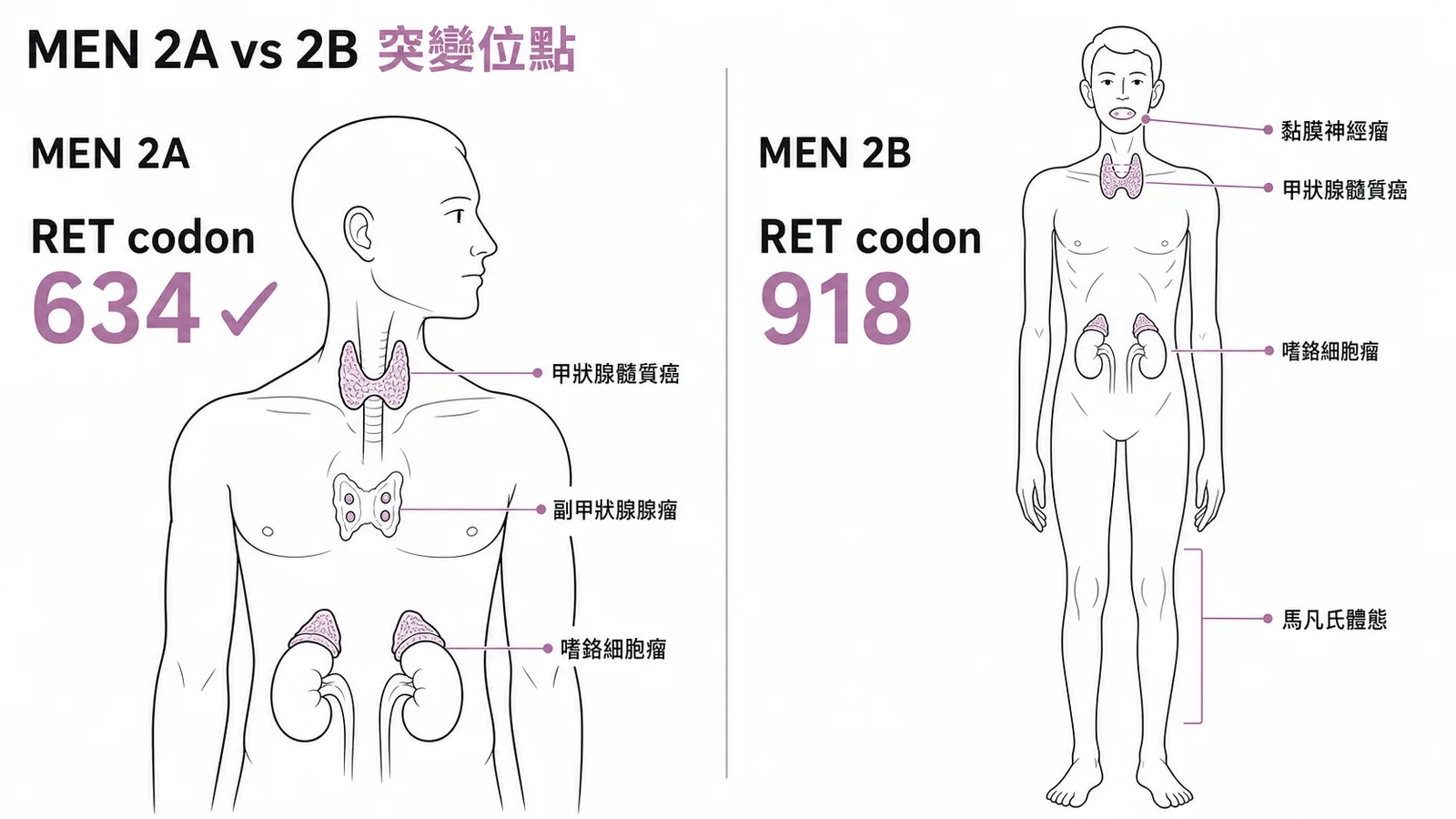 MEN 2A 最常見突變為 RET codon 634,MEN 2B 為 codon 918,兩者臨床表現對照