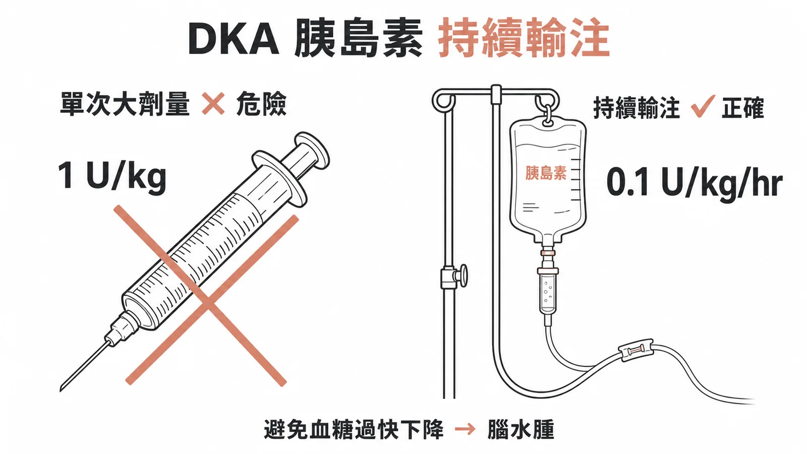 DKA 胰島素治療:單次大劑量注射錯誤,應以 0.1 U/kg/hr 持續靜脈輸注避免腦水腫