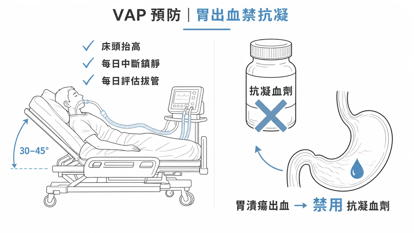 VAP 預防措施:床頭抬高、中斷鎮靜、評估拔管皆正確,但胃出血患者禁用抗凝血劑
