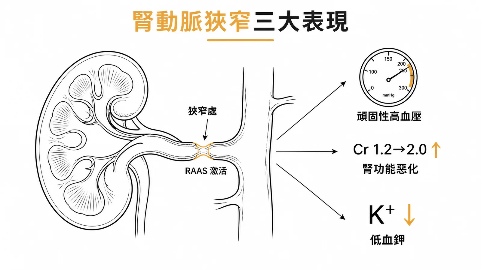 腎動脈狹窄三大表現：頑固性高血壓、Cr上升腎功能惡化、低血鉀