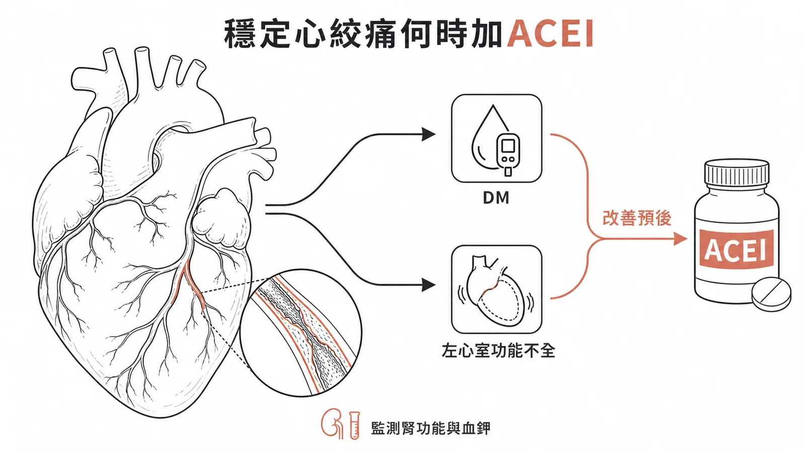 穩定心絞痛合併DM或左心室功能不全時加ACEI改善預後，須監測腎功能與血鉀
