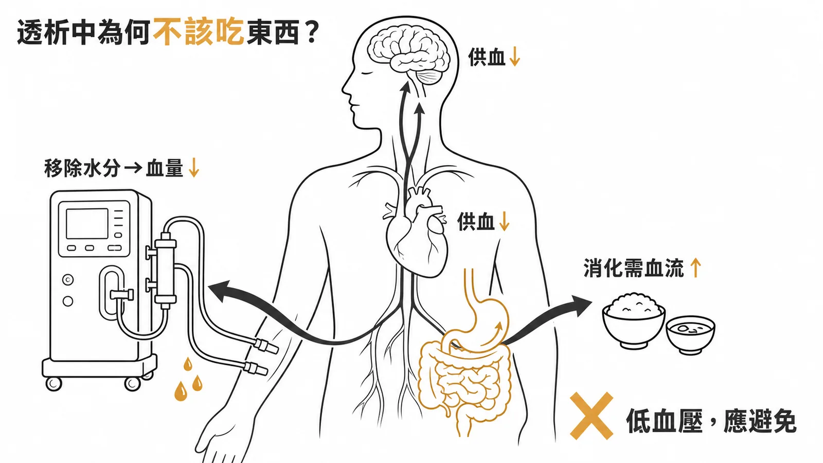 透析中進食引發低血壓機轉：透析移除水分使血量下降，同時進食使血流跑到腸胃道，雙重效應造成腦心供血不足