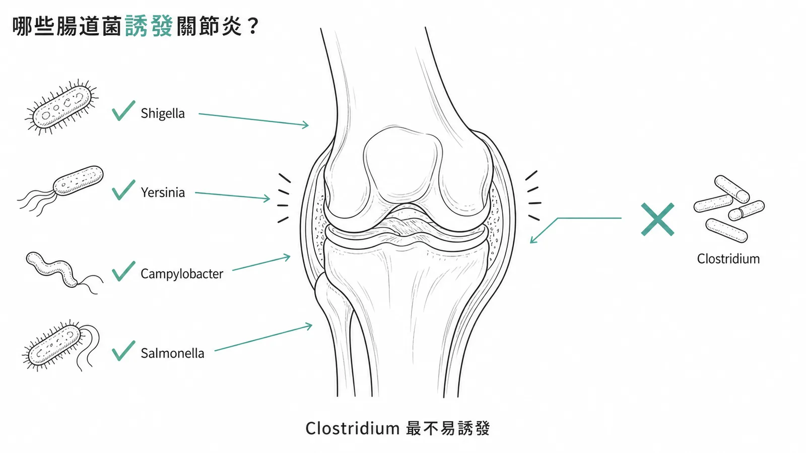 反應性關節炎腸道誘發菌：Shigella、Yersinia、Campylobacter、Salmonella 會誘發，Clostridium 最不易誘發