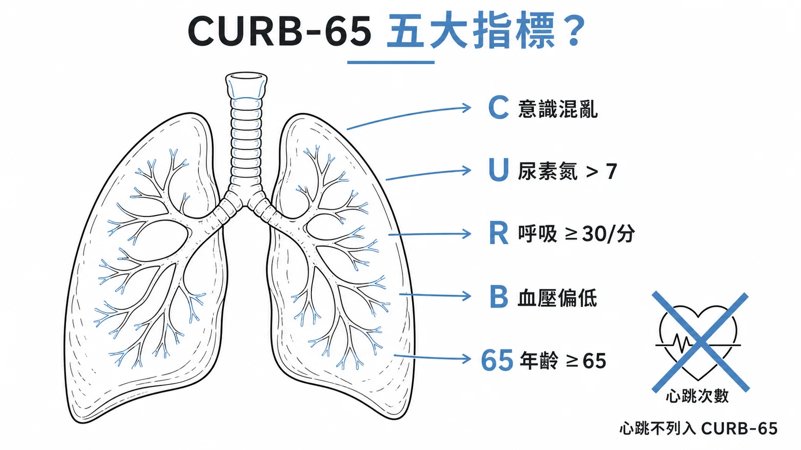 CURB-65 五大指標示意圖：C 意識混亂、U 尿素氮、R 呼吸次數、B 血壓、65 歲，心跳次數不列入