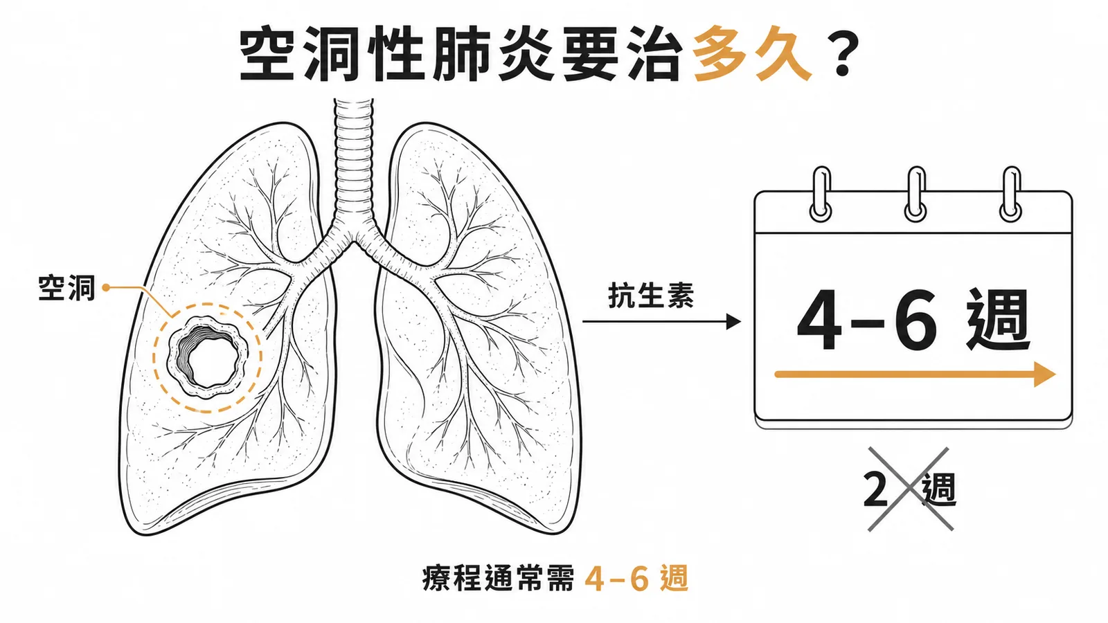 空洞性肺炎治療時間示意圖:需 4-6 週抗生素,2 週不夠