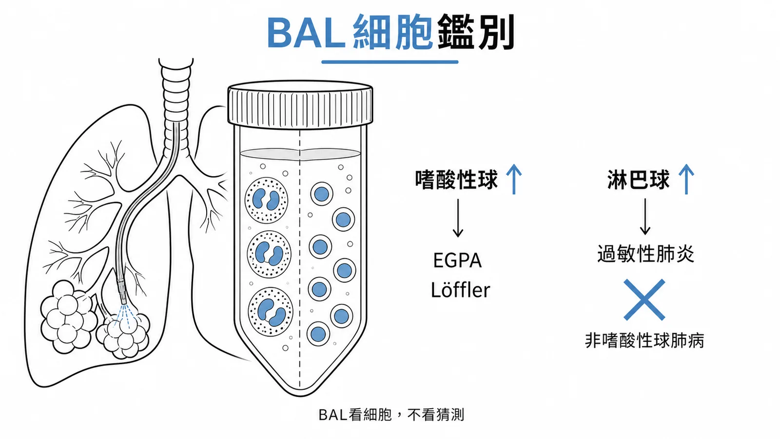 BAL細胞鑑別:嗜酸性球肺病vs過敏性肺炎的灌洗液差異