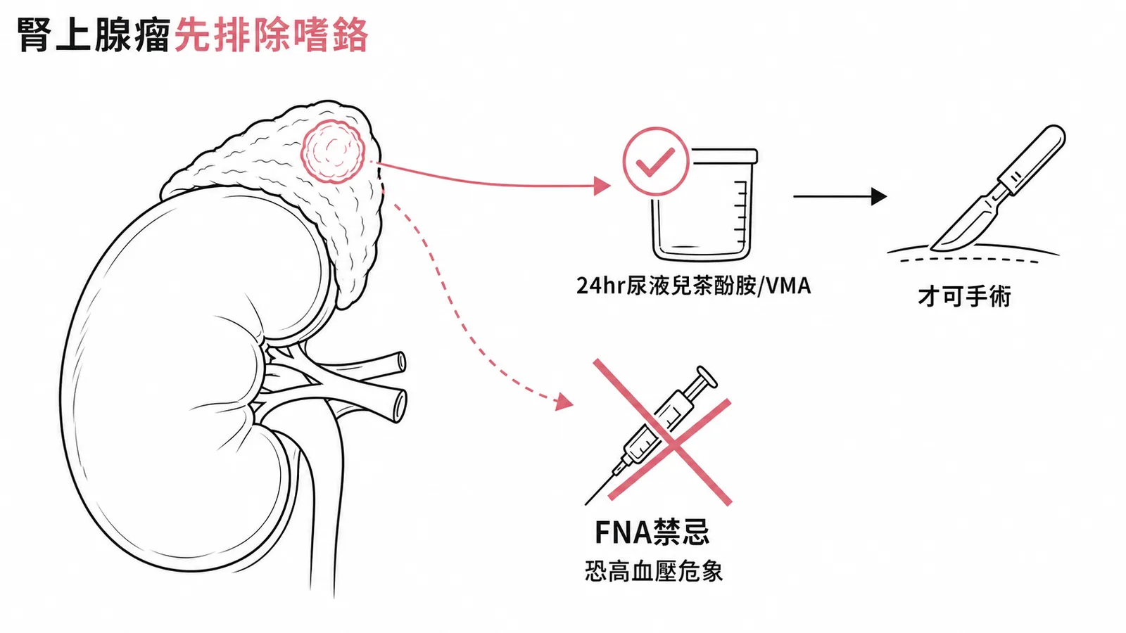 腎上腺偶發瘤合併高血壓須先排除嗜鉻細胞瘤再手術