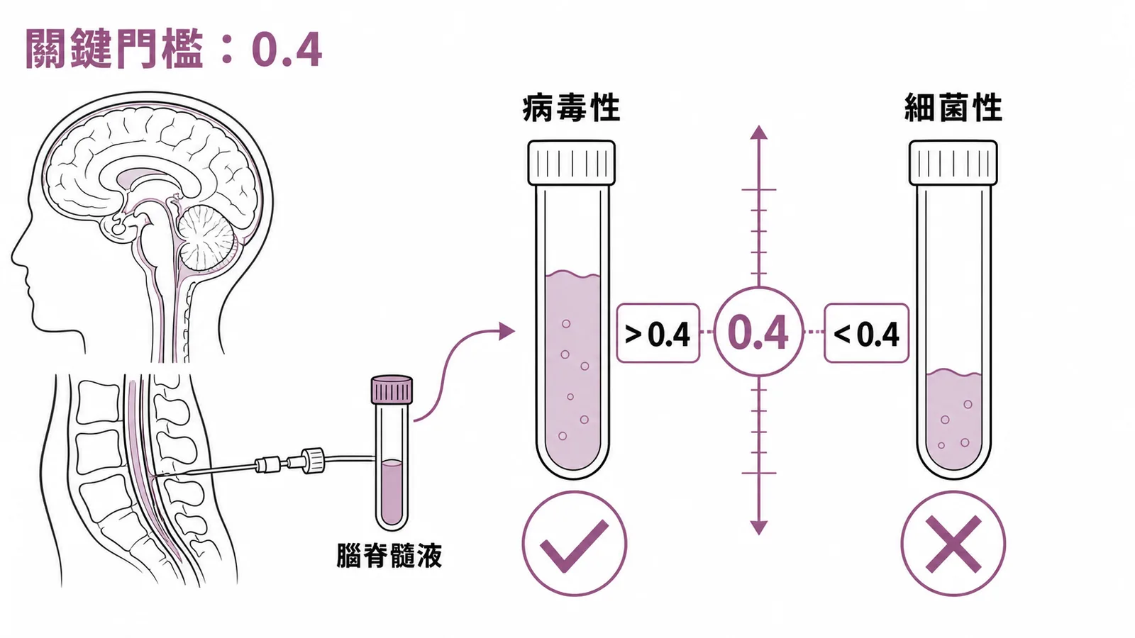 病毒性腦炎CSF葡萄糖比值大於0.4，細菌性腦膜炎小於0.4的對照圖