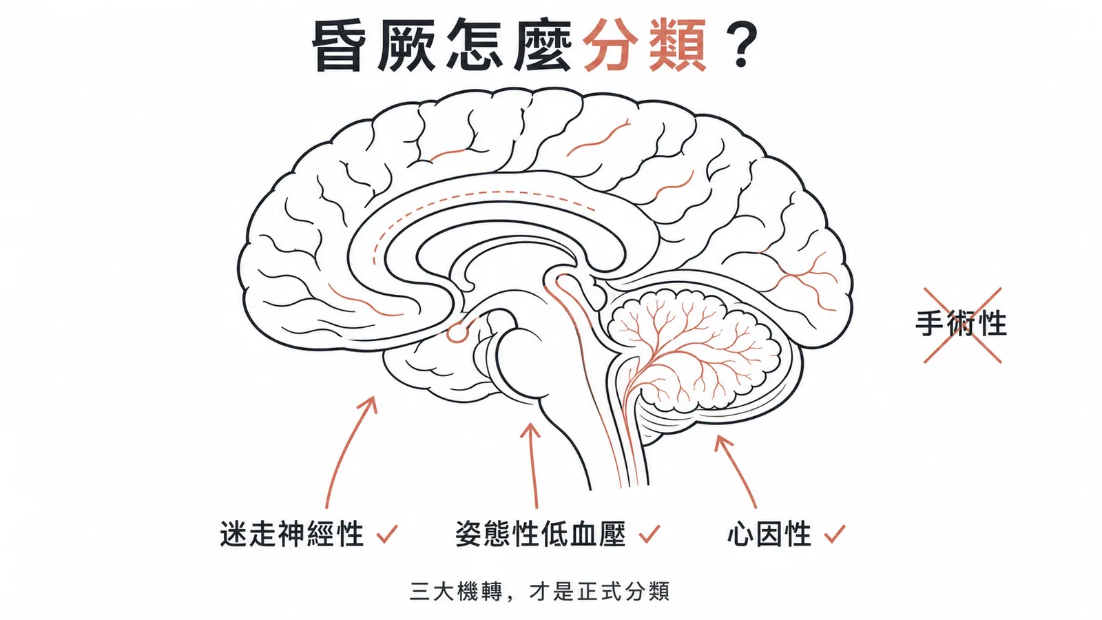 昏厥三大生理分類示意圖，迷走神經性、姿態性低血壓與心因性各有獨立機轉