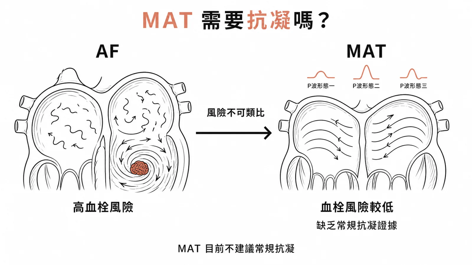 MAT血栓風險低於AF,目前缺乏常規抗凝治療的證據支持