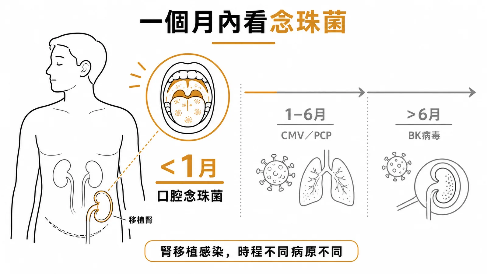 腎臟移植術後感染時程:口腔念珠菌好發一個月內,CMV和PCP在一至六個月