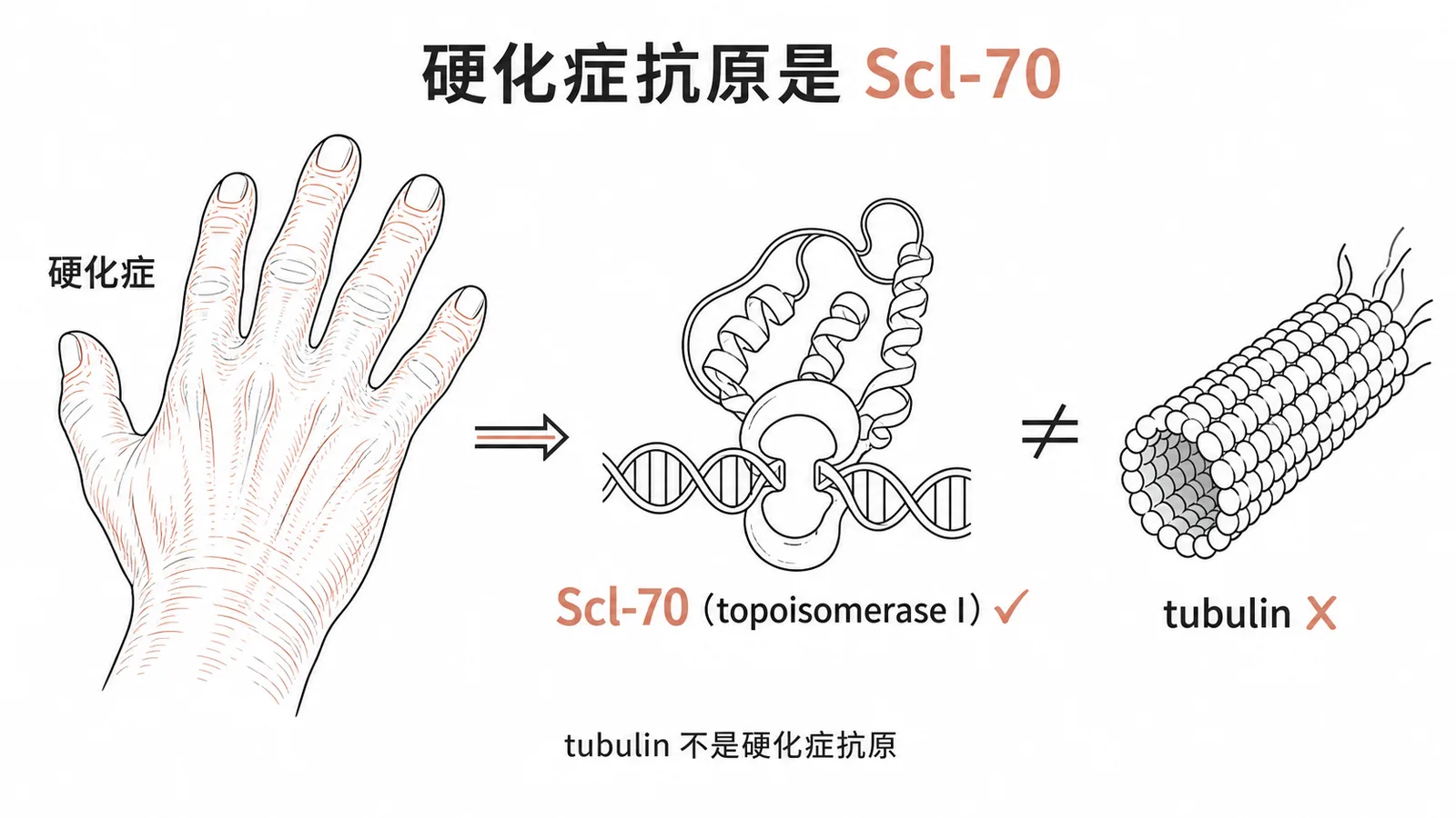 進行性全身性硬化症自體抗原並非 tubulin 的示意圖