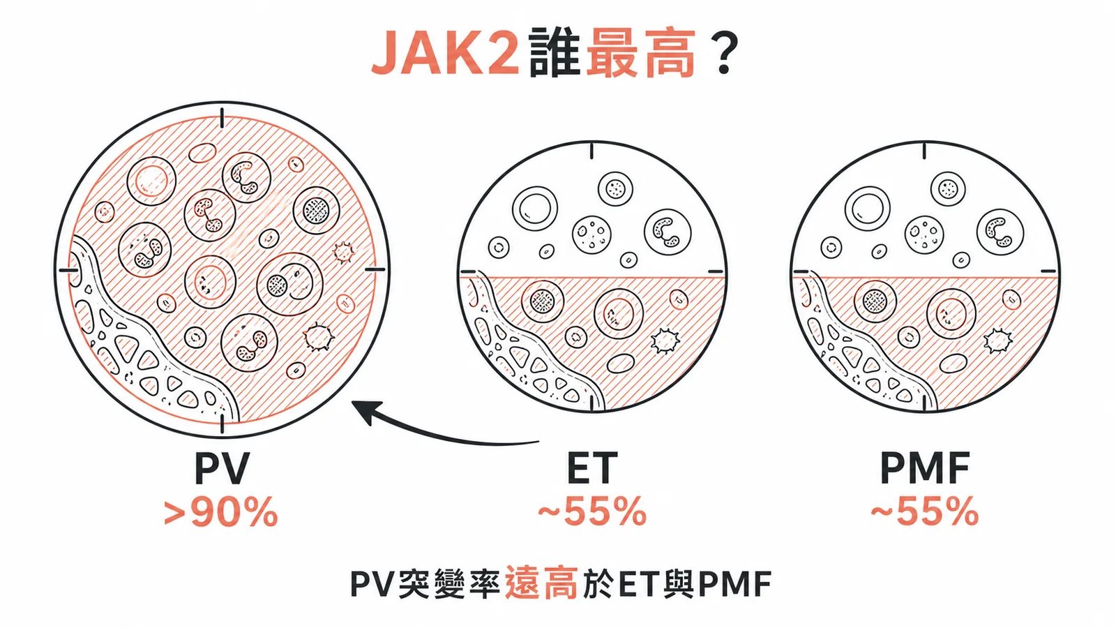 JAK2 V617F 突變在真性紅血球增多症中發生率超過九成的示意圖