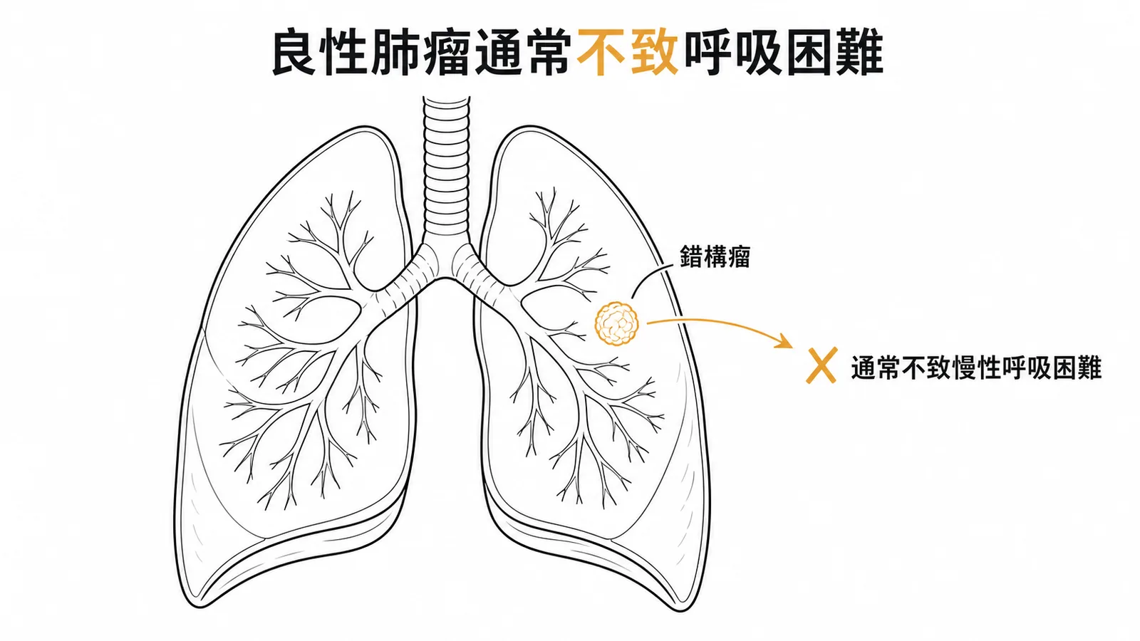 肺部良性腫瘤如錯構瘤通常不造成慢性呼吸困難