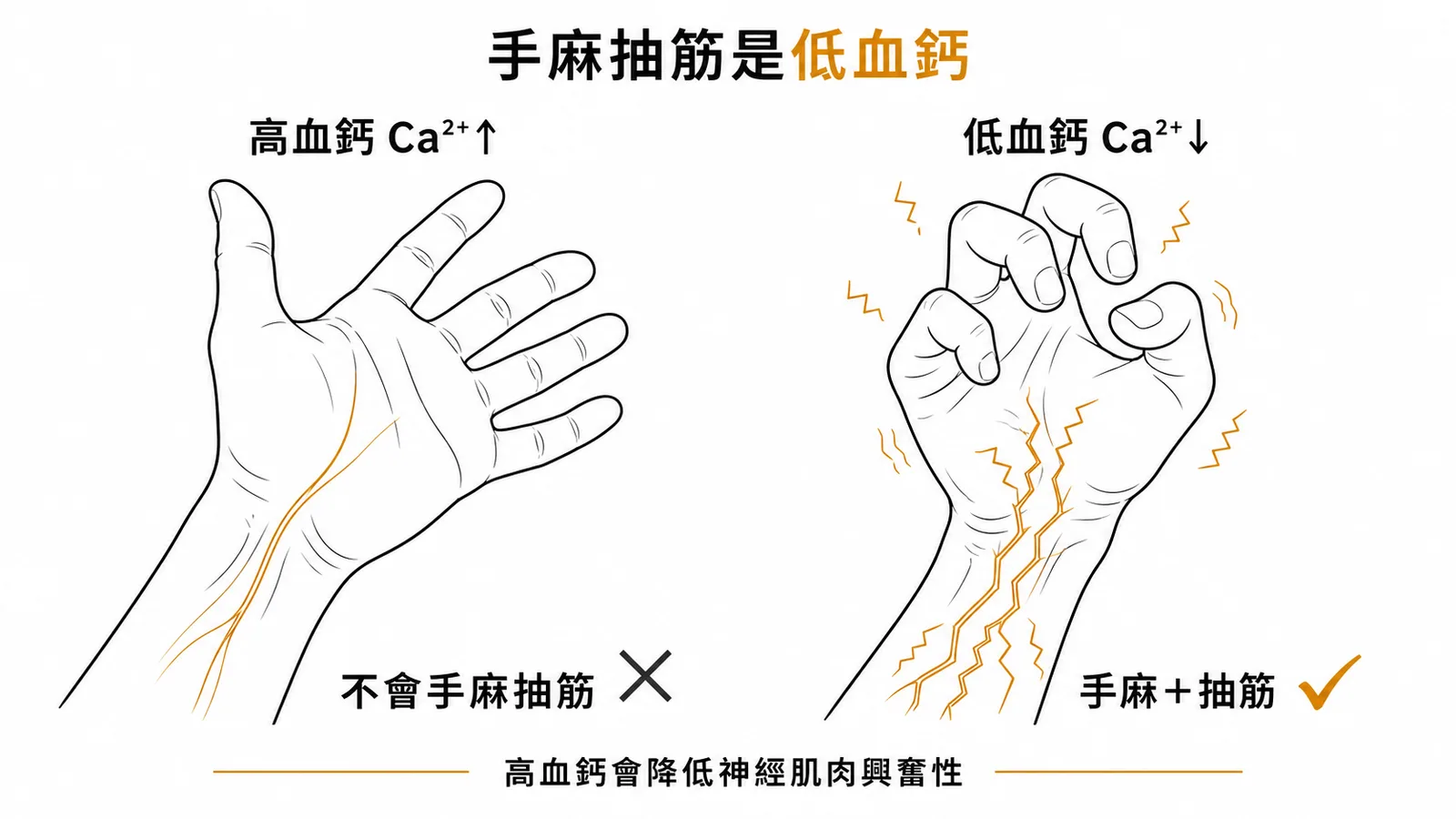 高血鈣降低神經肌肉興奮性，手麻抽筋是低血鈣症狀而非高血鈣