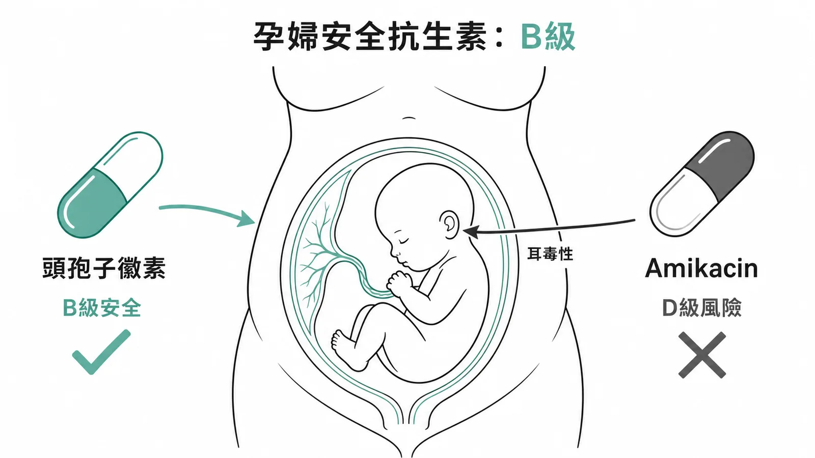 懷孕用藥安全分級:頭孢子黴素 B 級安全,胺基醣苷 D 級有耳毒性風險