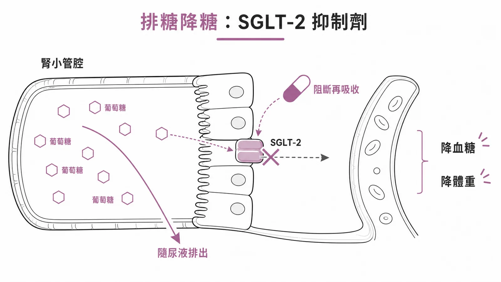 SGLT-2 抑制劑機轉:腎臟排出葡萄糖達到降血糖、降體重效果