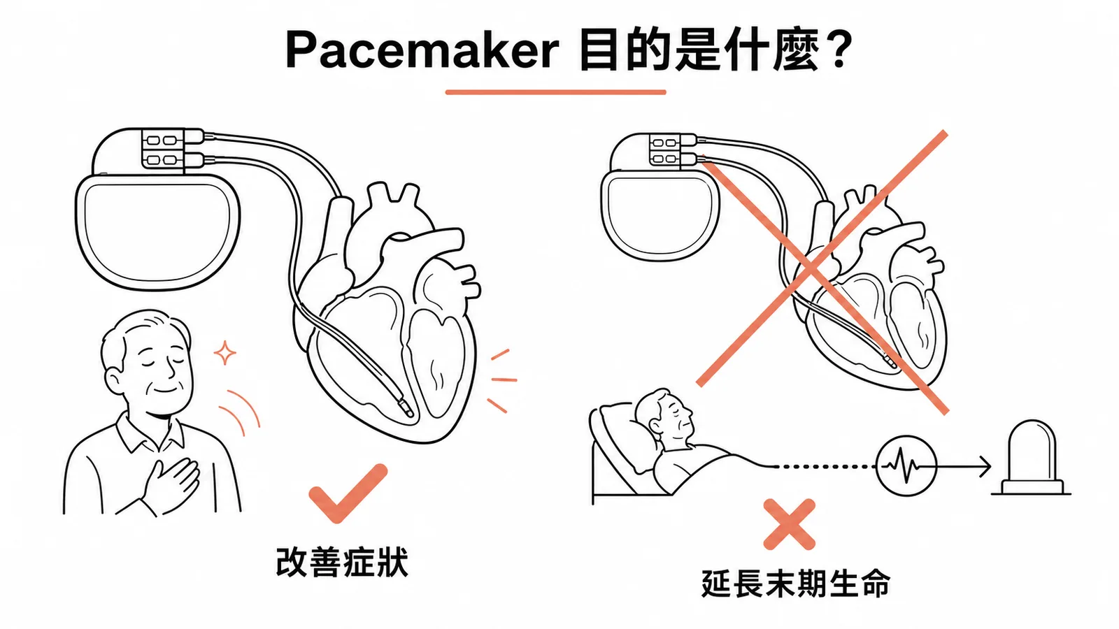 心律調節器改善症狀而非延長末期生命