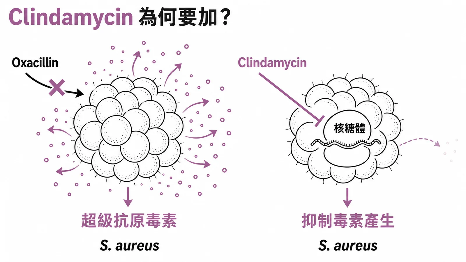 Clindamycin 抑制細菌毒素產生的機制對比圖