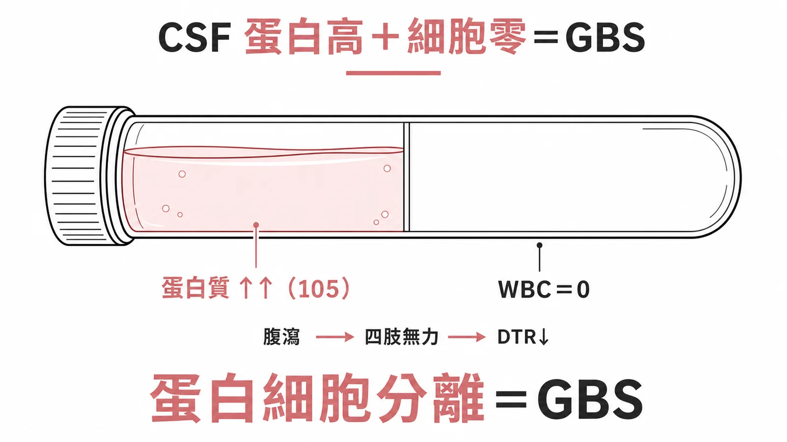CSF 蛋白質高(105)但 WBC 為零:蛋白細胞分離是 GBS 特徵