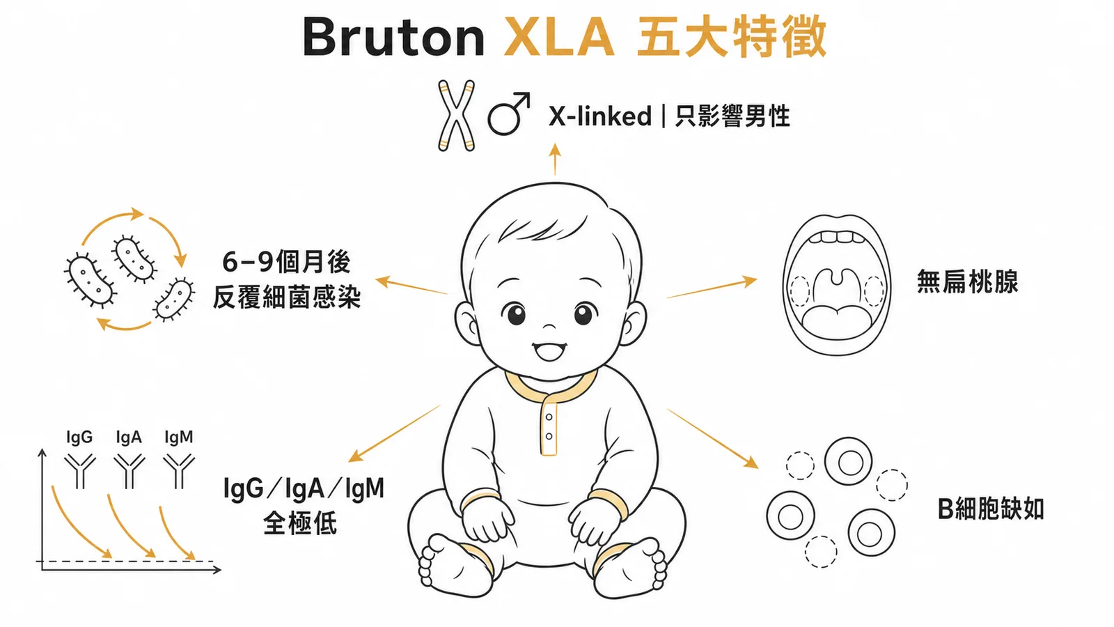Bruton XLA五大特徵:X-linked男嬰、反覆細菌感染、無扁桃腺、全Ig極低、B細胞缺如