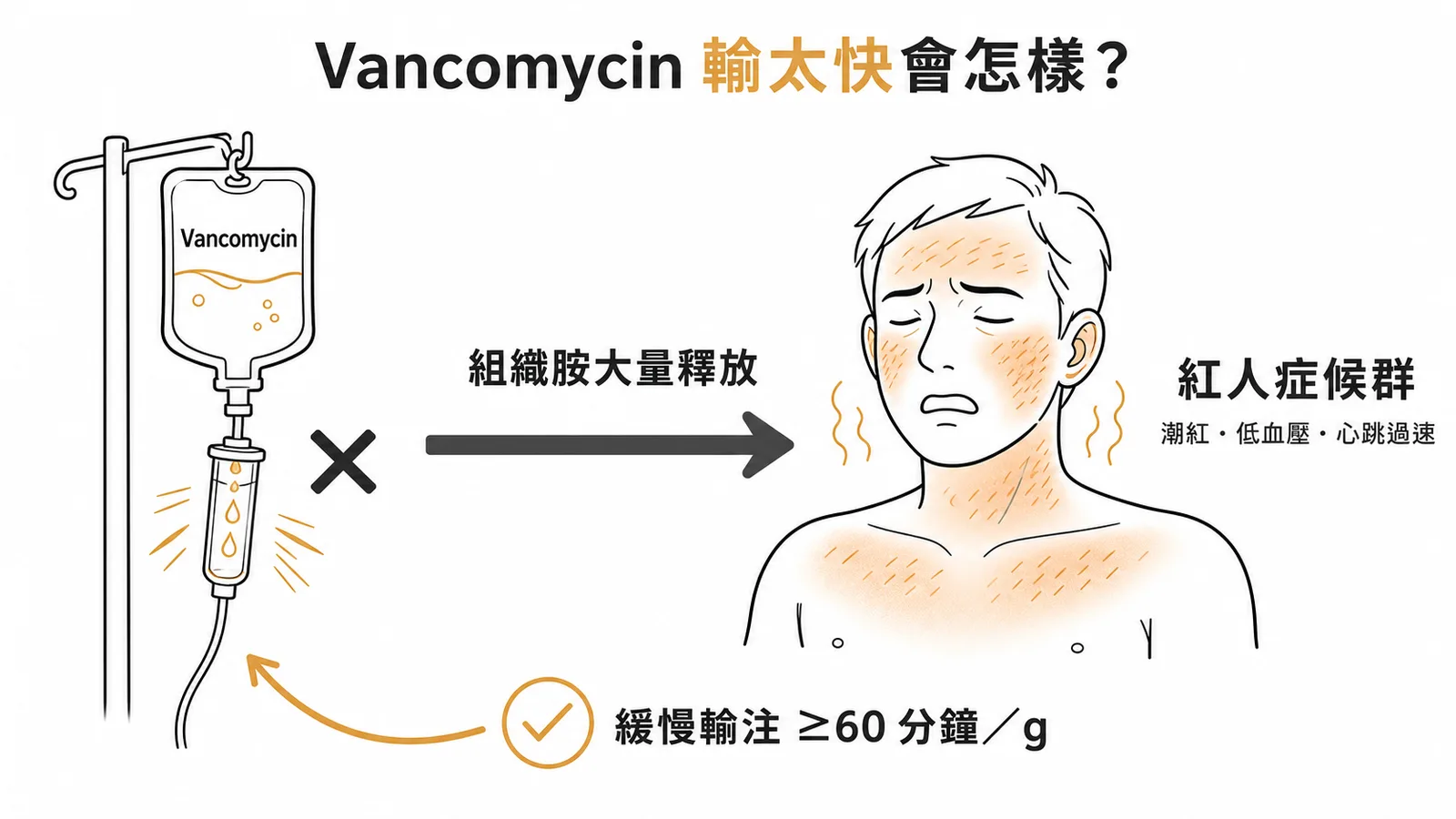 Vancomycin快速輸注導致紅人症候群的機轉與正確輸注速率
