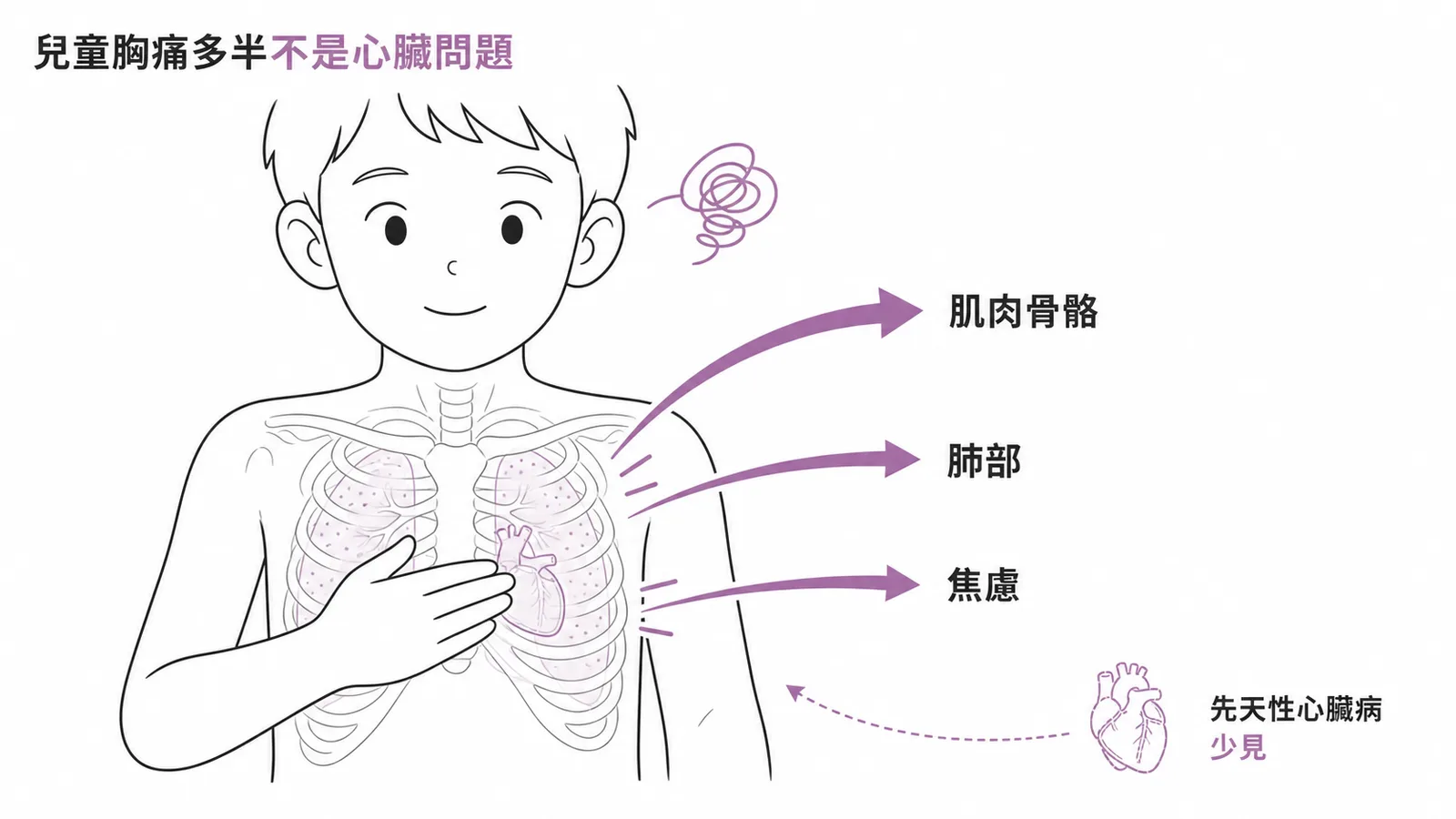 兒童胸痛常見原因為肌肉骨骼肺部焦慮而非心臟問題