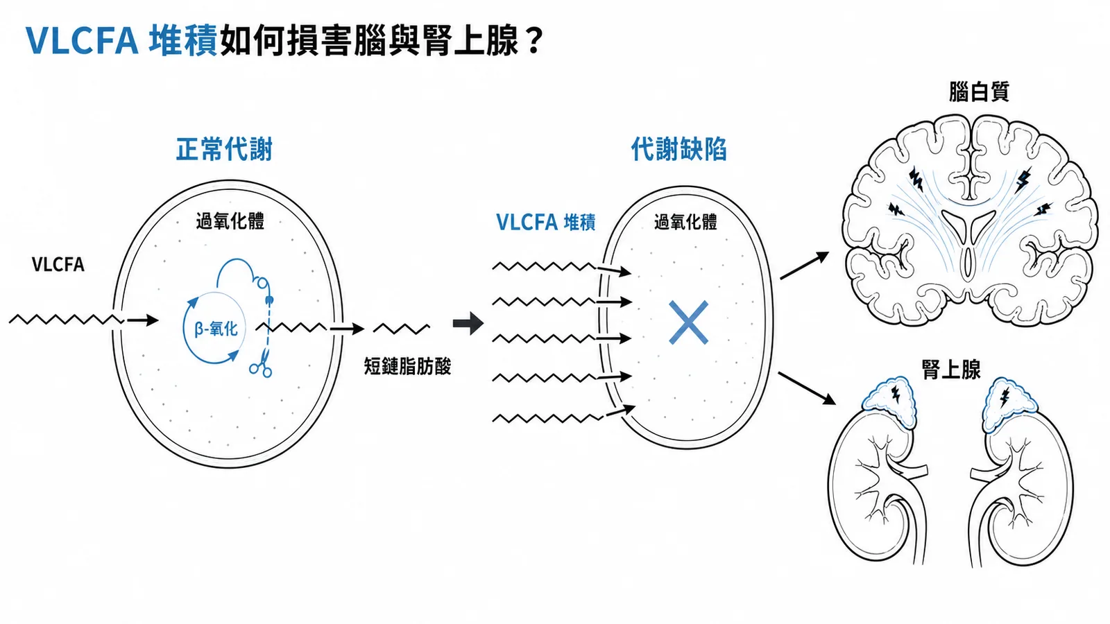 VLCFA堆積導致腦白質與腎上腺損傷的機轉示意圖