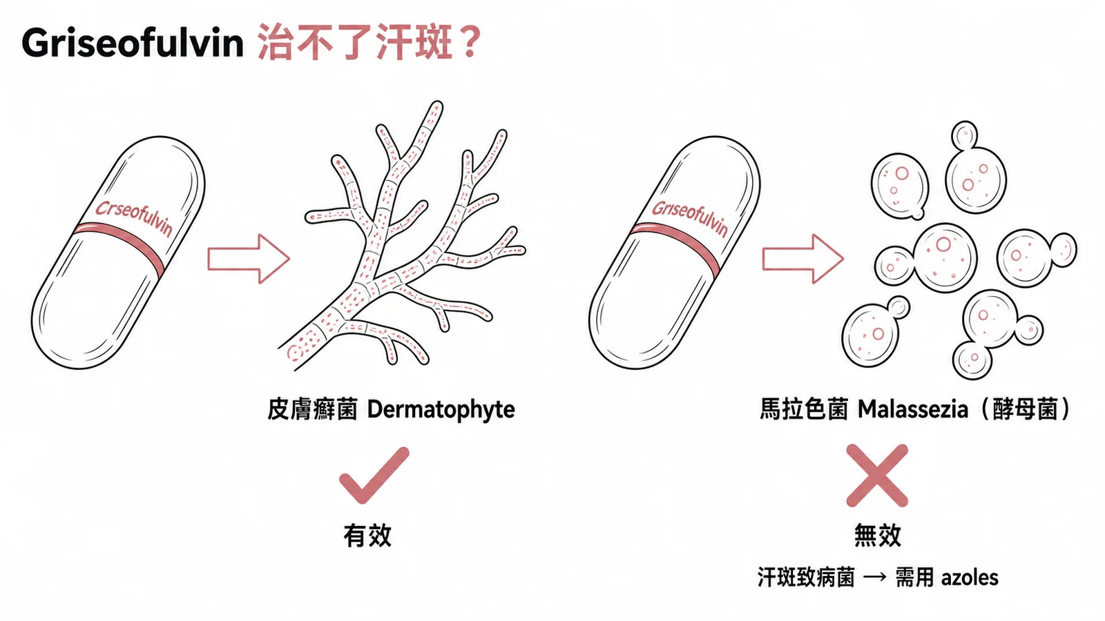 Griseofulvin只對皮膚癬菌有效,對汗斑致病菌馬拉色菌無效