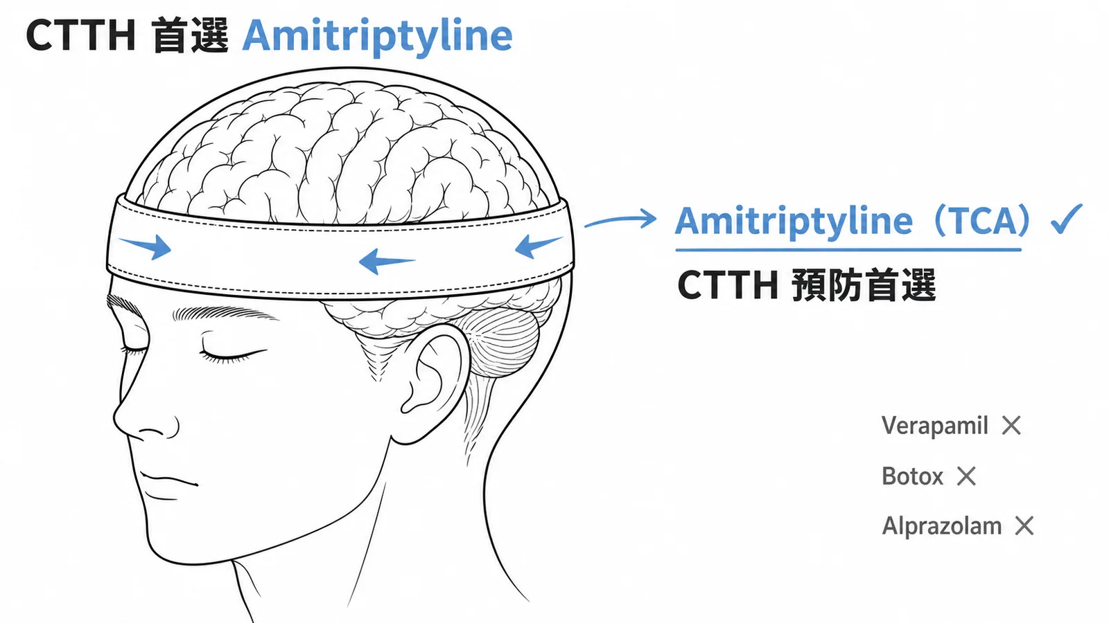 慢性緊縮性頭痛預防首選Amitriptyline