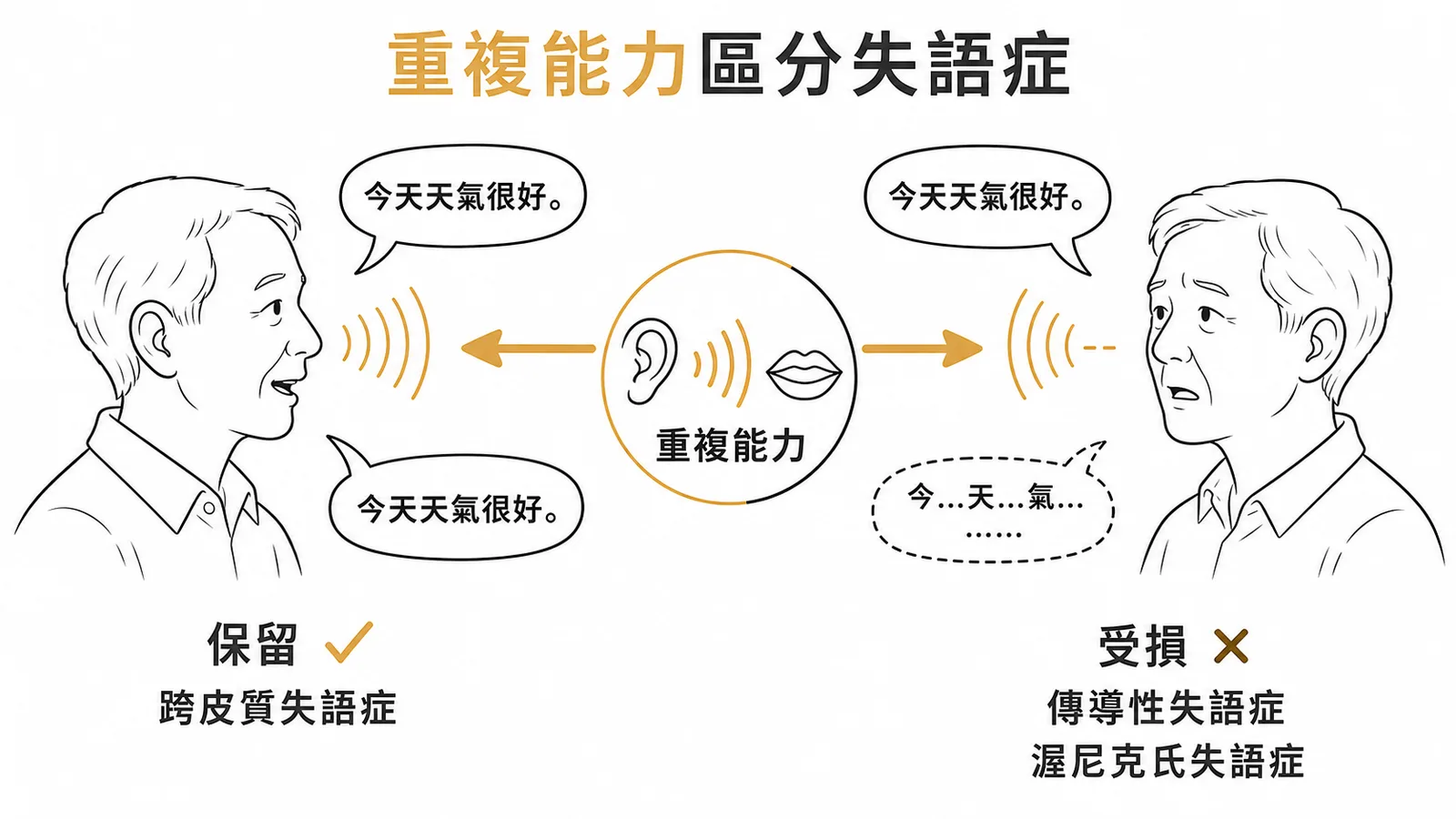 重複能力保留是跨皮質失語症的關鍵特徵