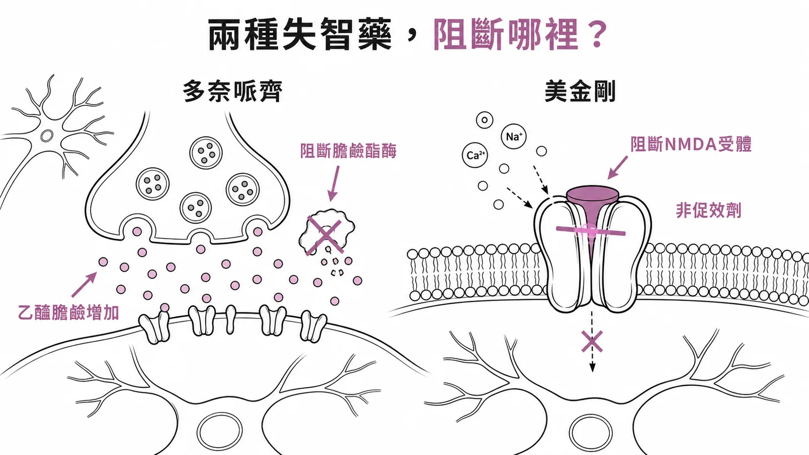 Donepezil與Memantine作用機轉對照:膽鹼酯酶抑制vs NMDA受體拮抗