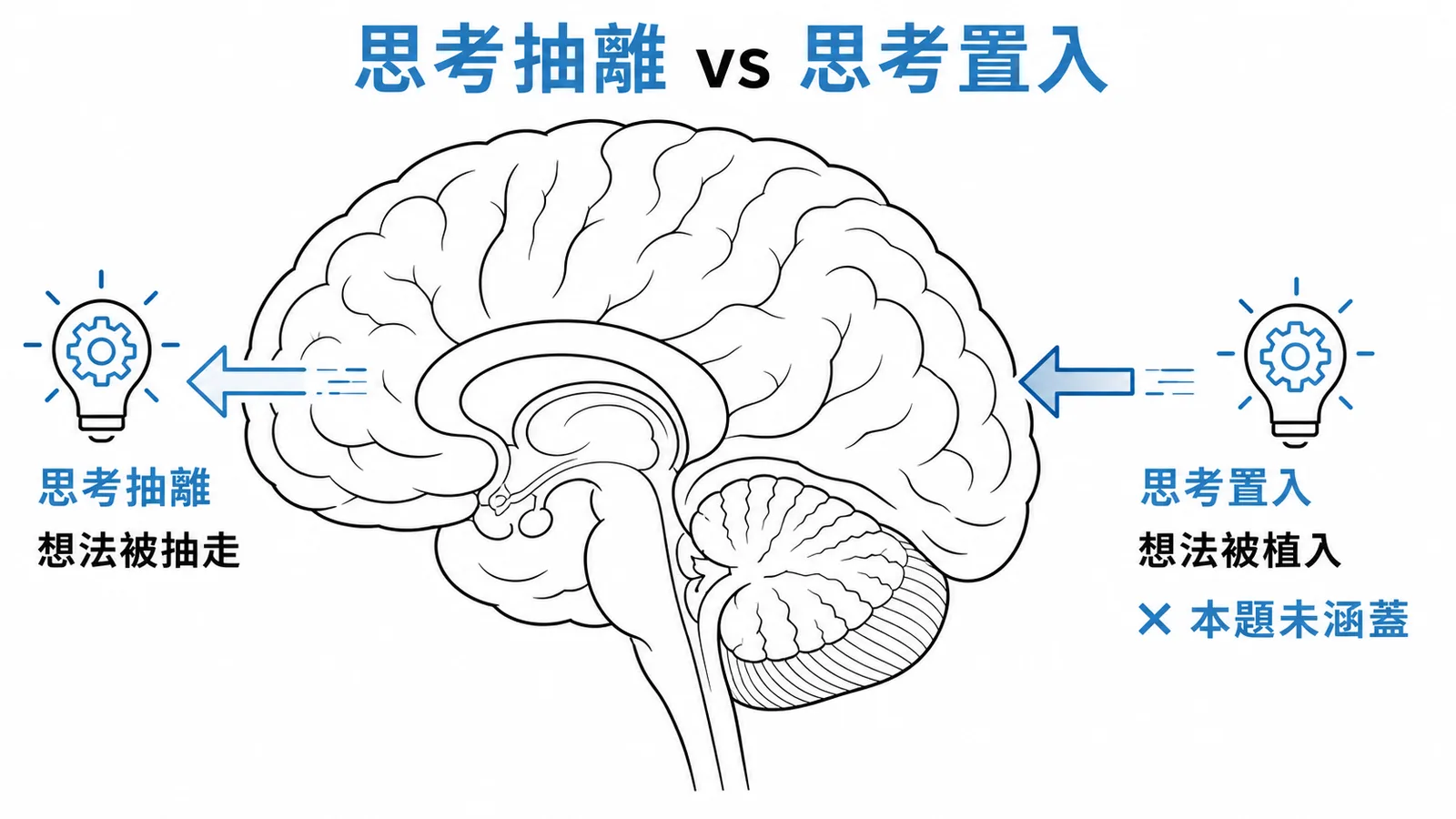 思考抽離與思考置入的差異：想法被外力抽走 vs 被植入，本題未涵蓋思考置入