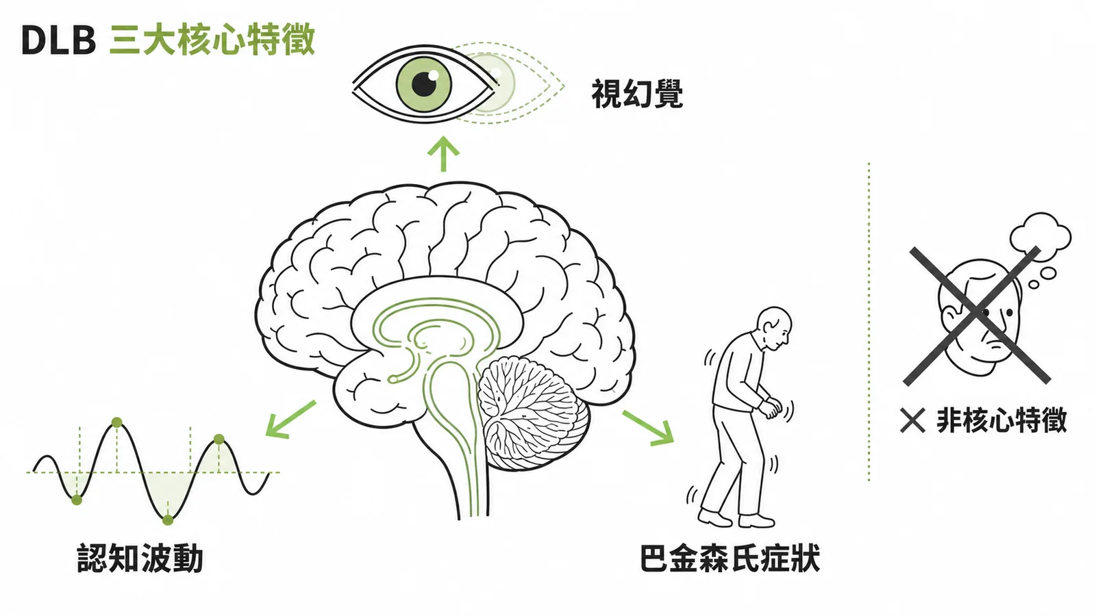 DLB 三大核心特徵：反覆視幻覺、認知波動、巴金森氏症狀，結構性妄想非核心特徵