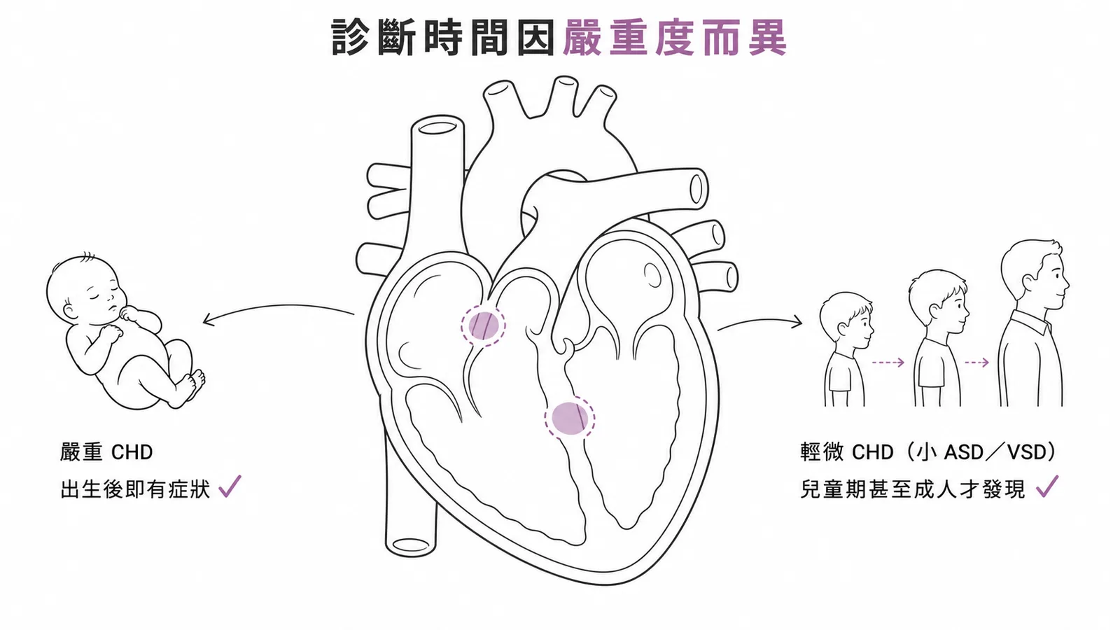 先天性心臟病診斷時間因嚴重度而異：嚴重CHD出生即有症狀，輕微CHD如小ASD/VSD可能到兒童或成人才發現