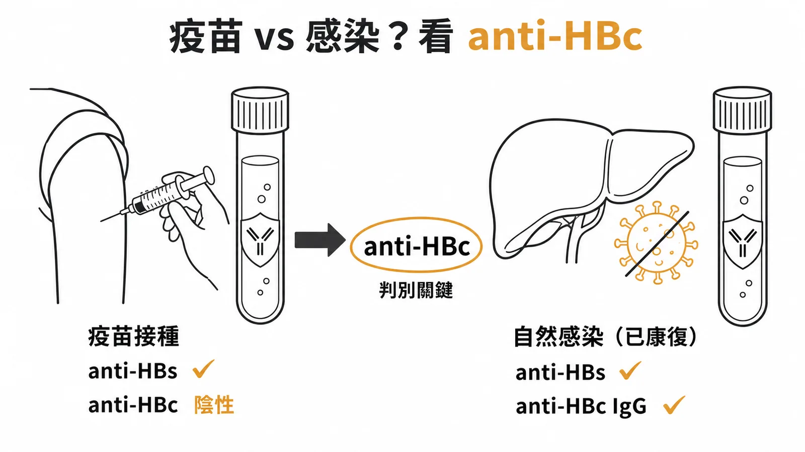 區分B肝疫苗與自然感染的關鍵：疫苗只產生anti-HBs，感染後還會有anti-HBc IgG