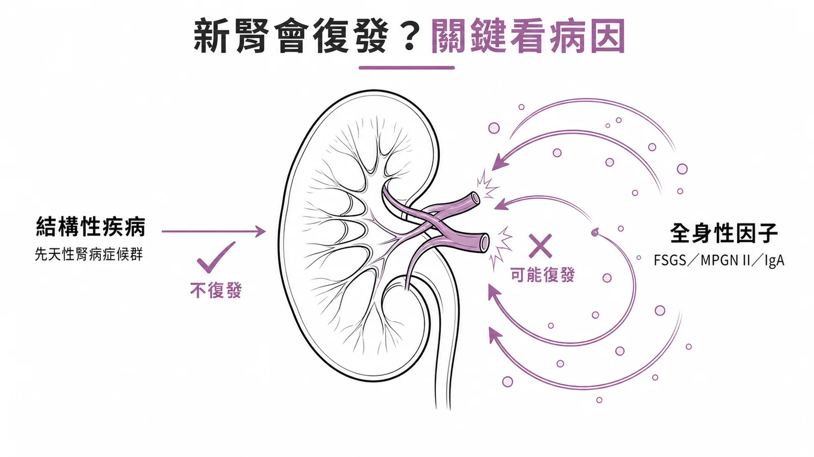 腎臟移植後復發風險：結構性疾病(先天性腎病症候群)不復發，全身性因子(FSGS/MPGN/IgA)可能復發