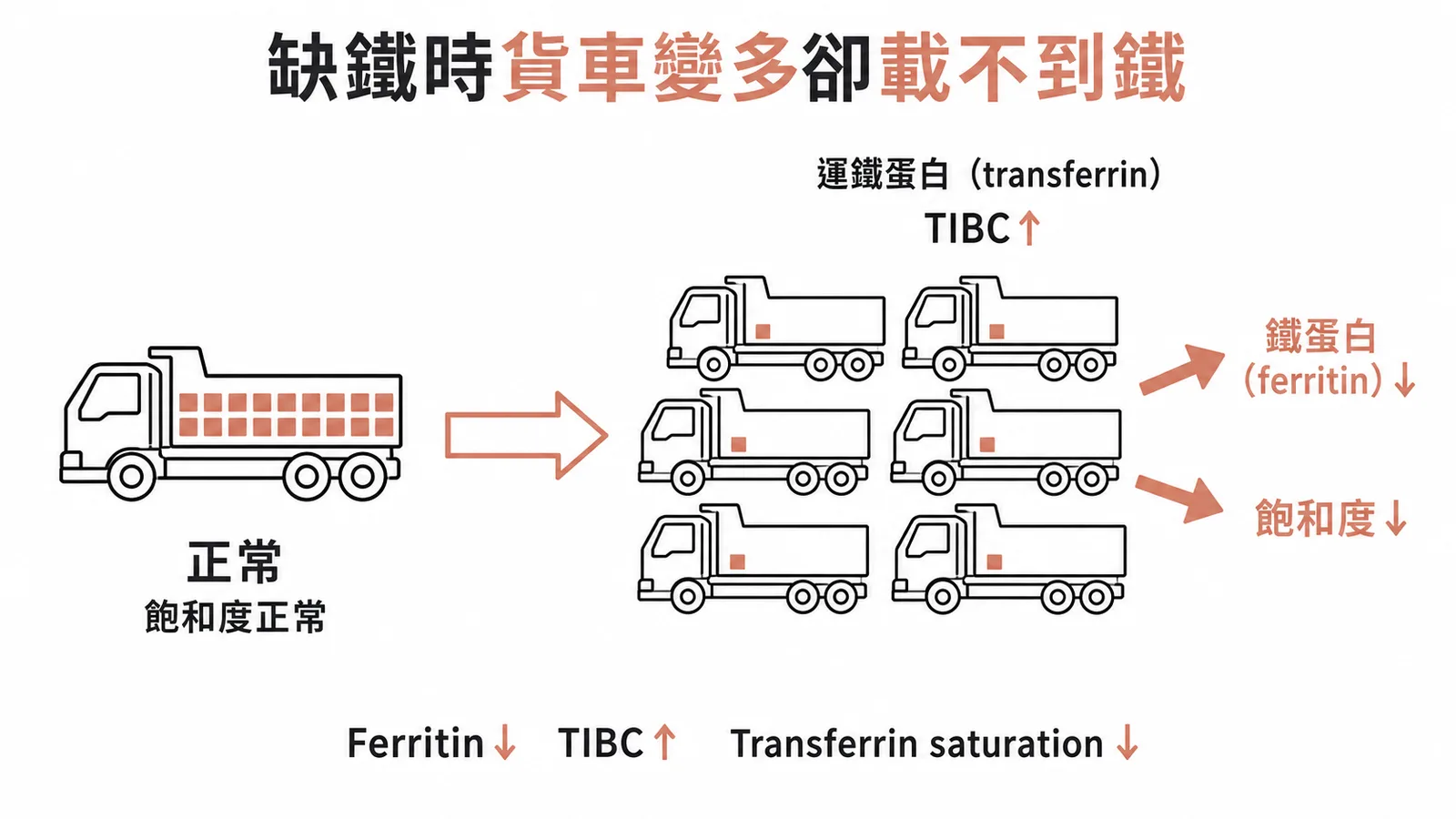 缺鐵性貧血鐵質檢驗：運鐵蛋白增多但飽和度下降的貨車比喻