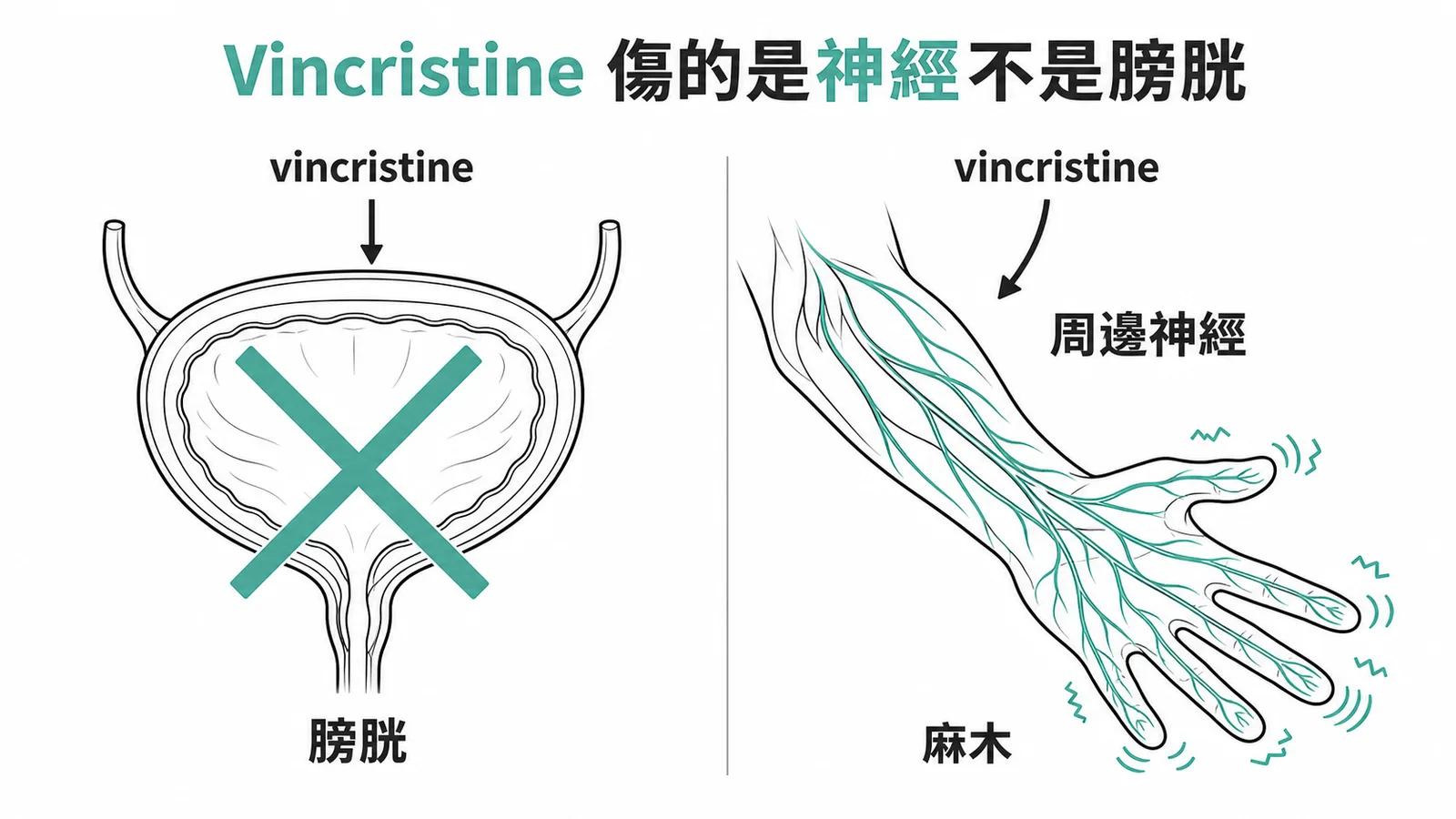 Vincristine的毒性是周邊神經病變，不是出血性膀胱炎
